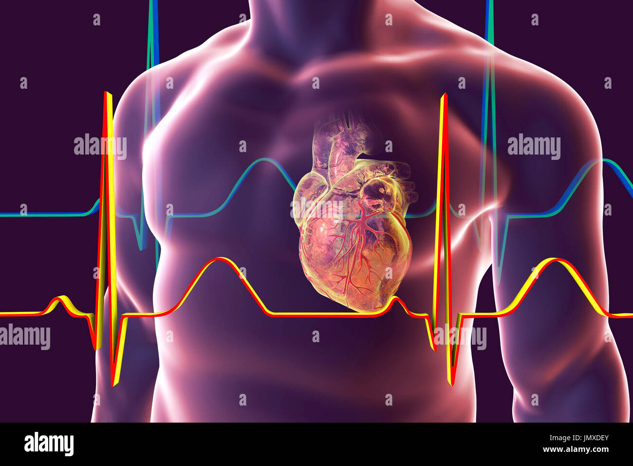 Heart with coronary vessels inside human body, computer illustration. Stock Photo