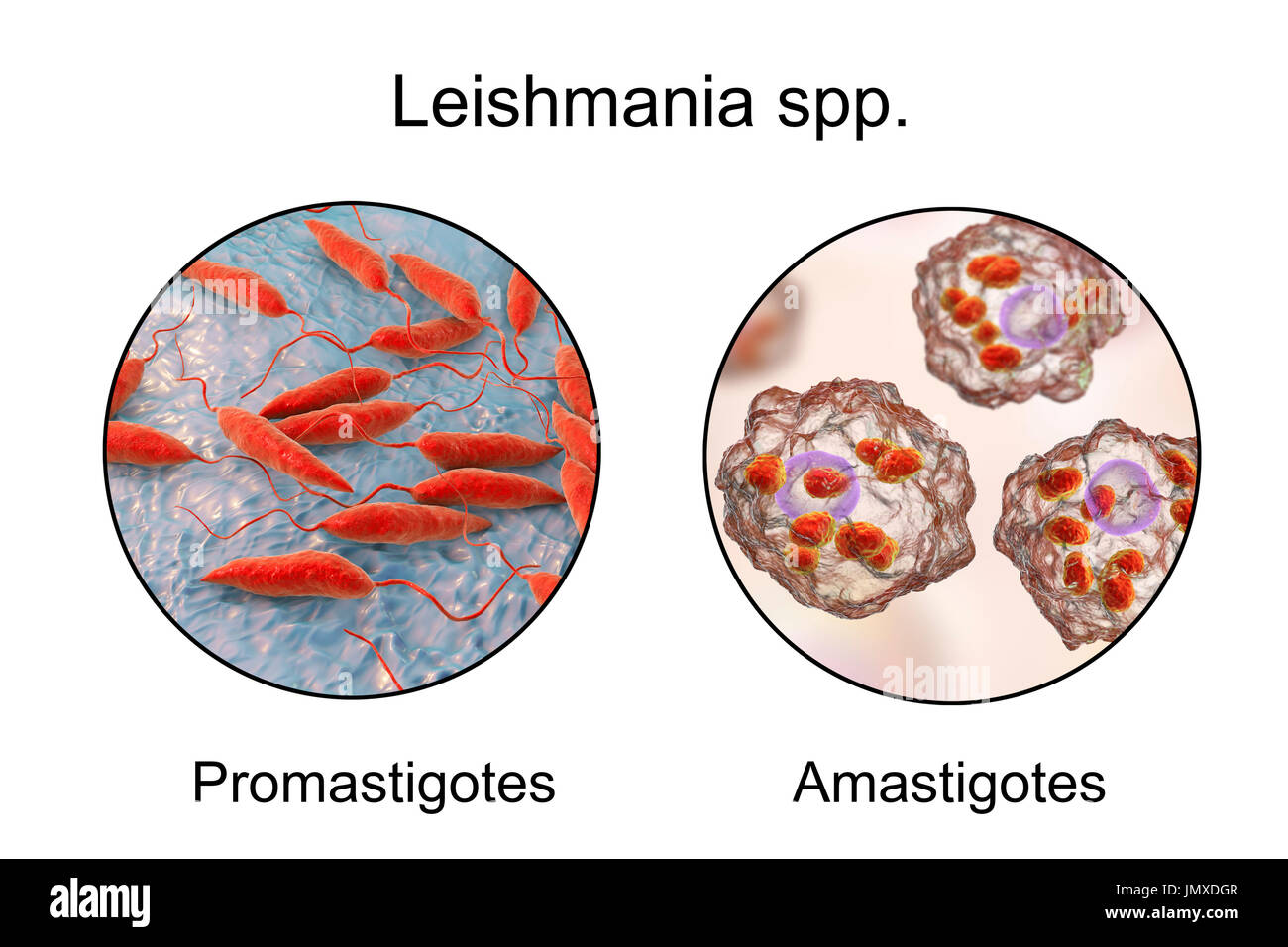 Promastigotes and amastigotes of Leishmania parasites inside macrophages, illustration. Leishmania sp. cause leishmaniosis, a tropical disease transmitted by bites from infected sand-flies. These are the flagellated promastigote form of the parasite. In humans the flagellated promastigotes stage infects macrophages and are transformed into the amastigote non-flagellated stage. There are two forms of leishmaniosis. The first, cutaneous leishmaniosis, affects the skin giving rise to an ulcer at the site of the bite. This mainly heals naturally, although scarring may occur. The more serious, Stock Photo