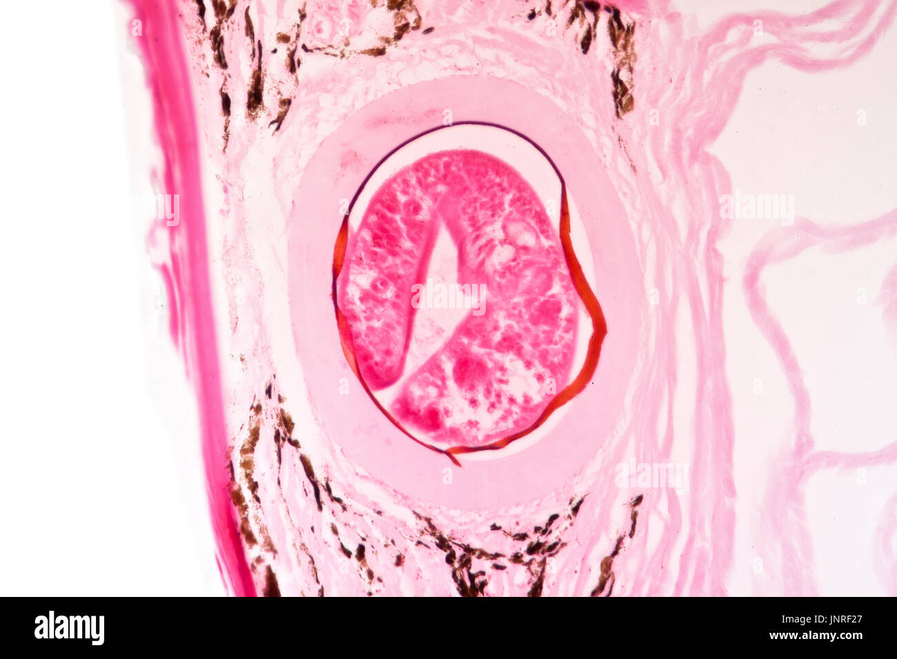 Trematoda metacercaria embedded in skin of cod, young fluke in cyst, brightfield photomicrograph Stock Photo