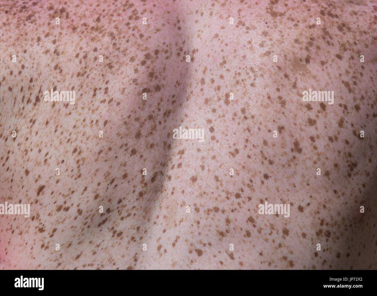 Close up of freckles on back of woman. Sensitive skin texture Stock Photo