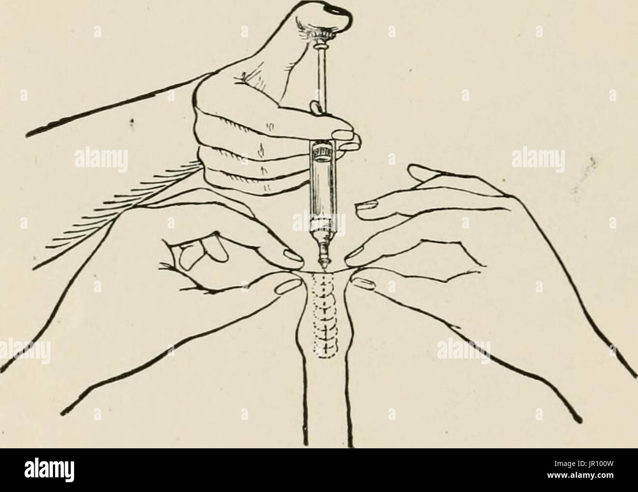 "Local and regional anesthesia; with chapters on spinal, epidural