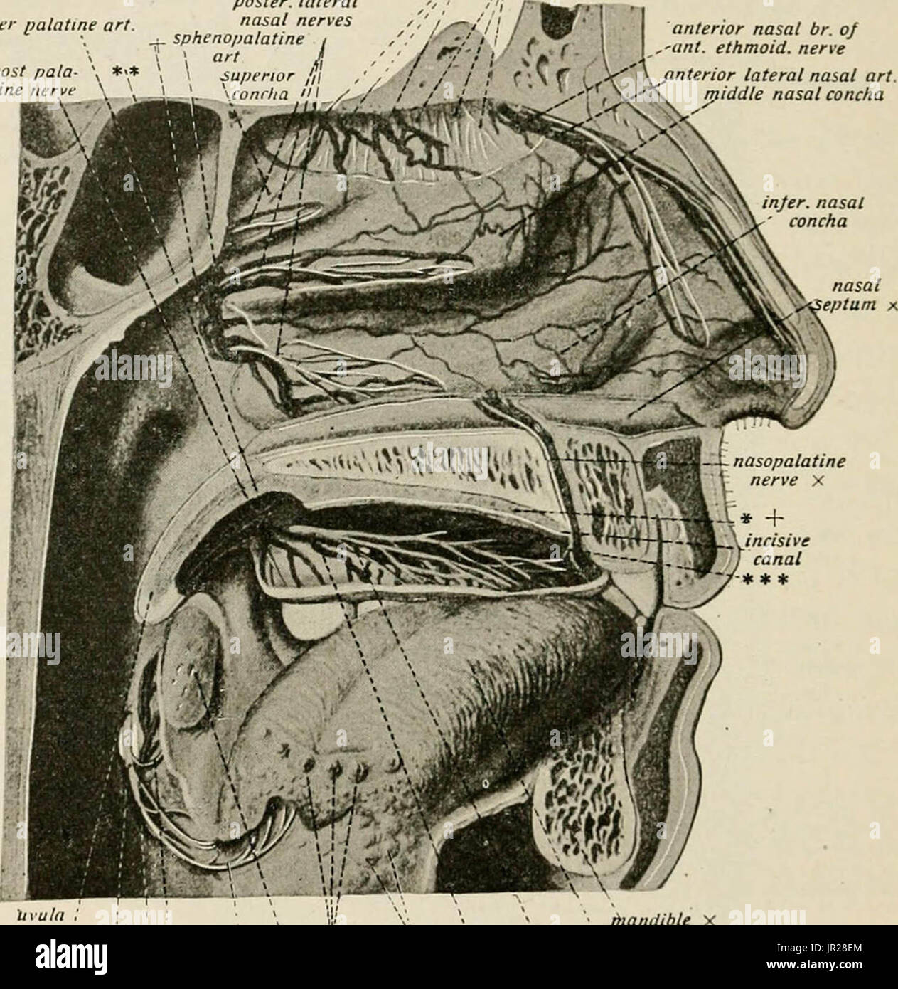 Local And Regional Anesthesia With Chapters On Spinal - 