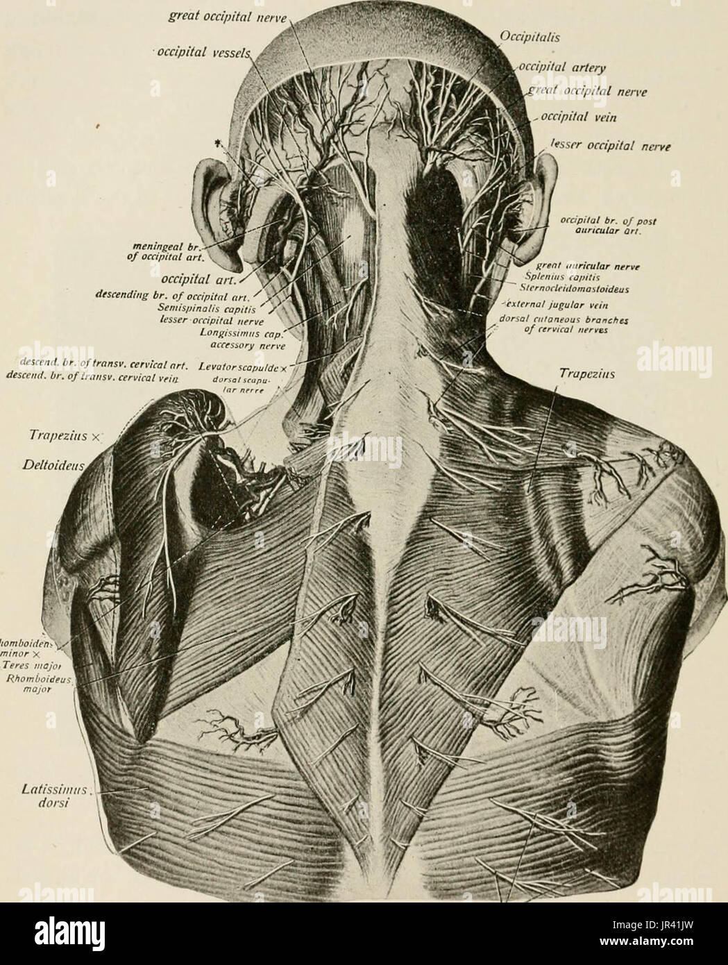 Local And Regional Anesthesia With Chapters On Spinal - 