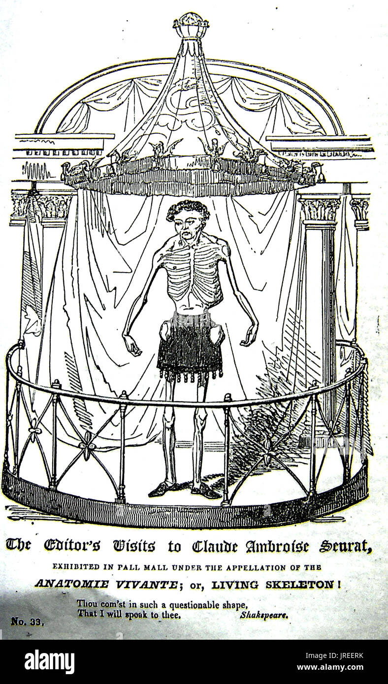 FREAK SHOW - Claude Ambroise Seurat the 'human living skeleton', said to suffer from a  5m long tapeworm - Aged 27 in  1825 Stock Photo