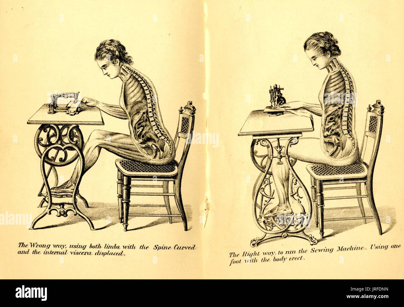 Posture book, showing an illustration of a woman sitting at a chair and using a sewing machine, with both the wrong way and right way to sit illustrated, the womans viscera and organs visible in a cutout view demonstrating how the proper posture for sitting causes the organs to be oriented correctly within the womans body, 1900. Stock Photo