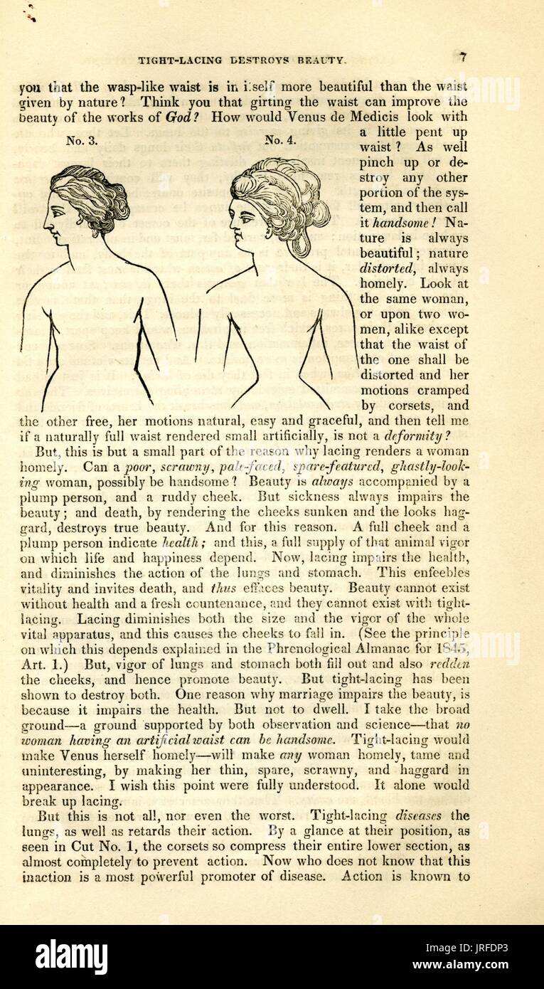 Tight lacing destroys beauty, book protesting against overly tight corsets  used by certain women, with illustration of the negative effects of the  corset on the womens hips and waist, 1900 Stock Photo 