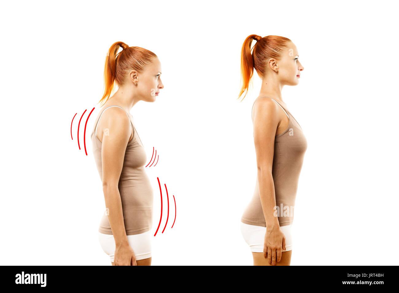 Young woman with position defect and ideal bearing Stock Photo - Alamy