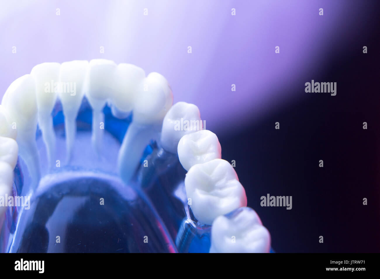 Dentists' dental teeth model showing tooth enamel, gums, roots, plaque