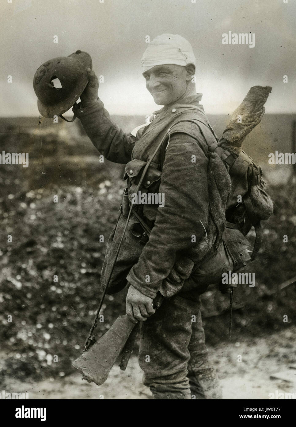 Saved by a shrapnel helmet - This soldier on the way to hospital after being bandaged at Field Dressing Station, shows the helmet which saved his life - Offical photograph of the Somme Advance Stock Photo