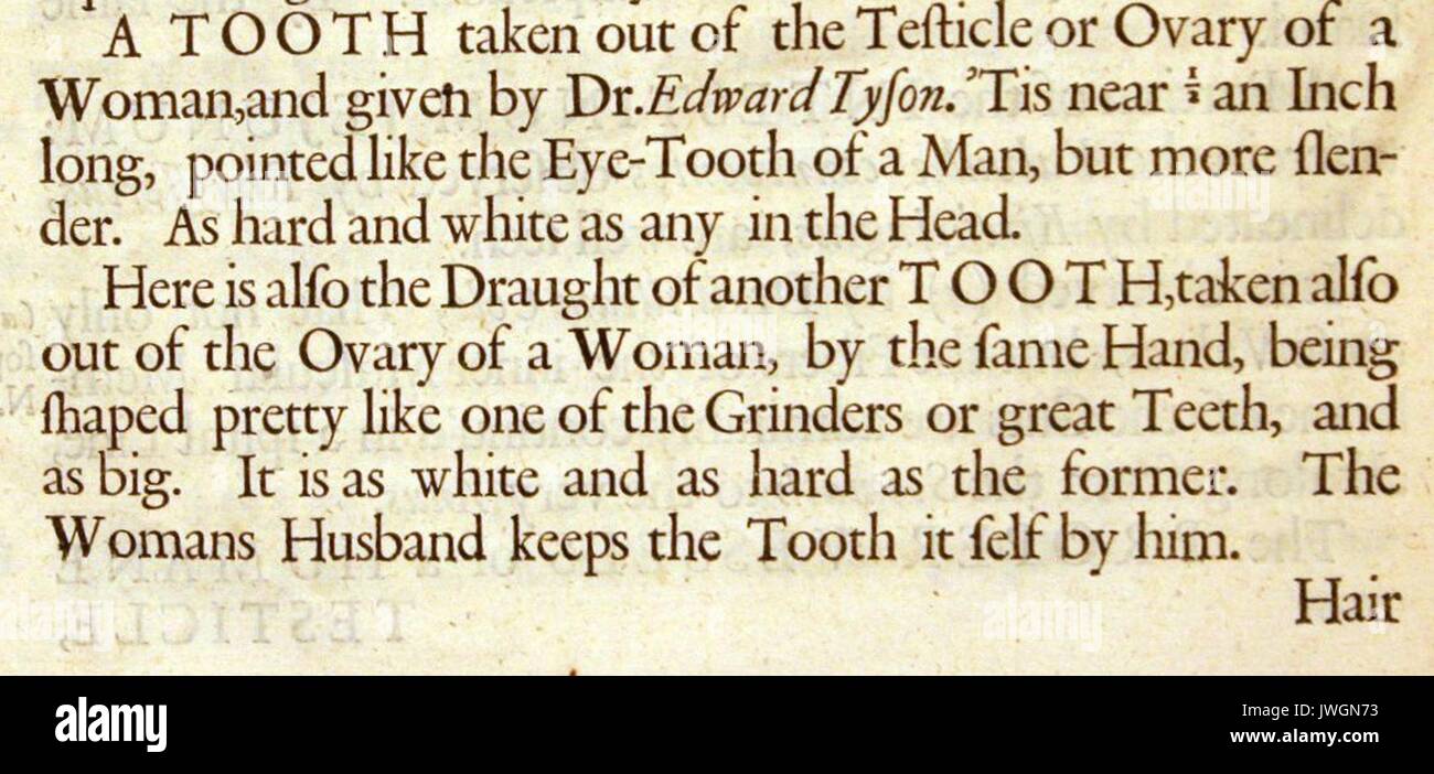 Medical description from an early treatise describing a tooth taken out of a testicle or ovary of a woman, 1800. Stock Photo