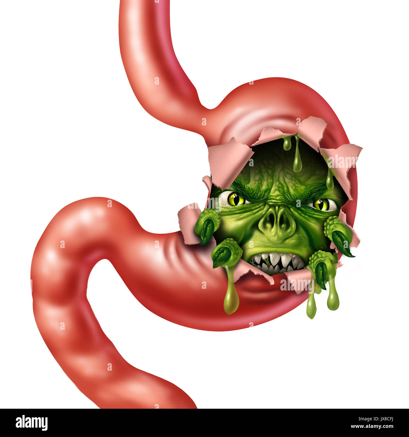 Upset stomach and nausea disease as an angry digestive organ character as a medical metaphor for indigestion and belly pain with gastric liquid. Stock Photo