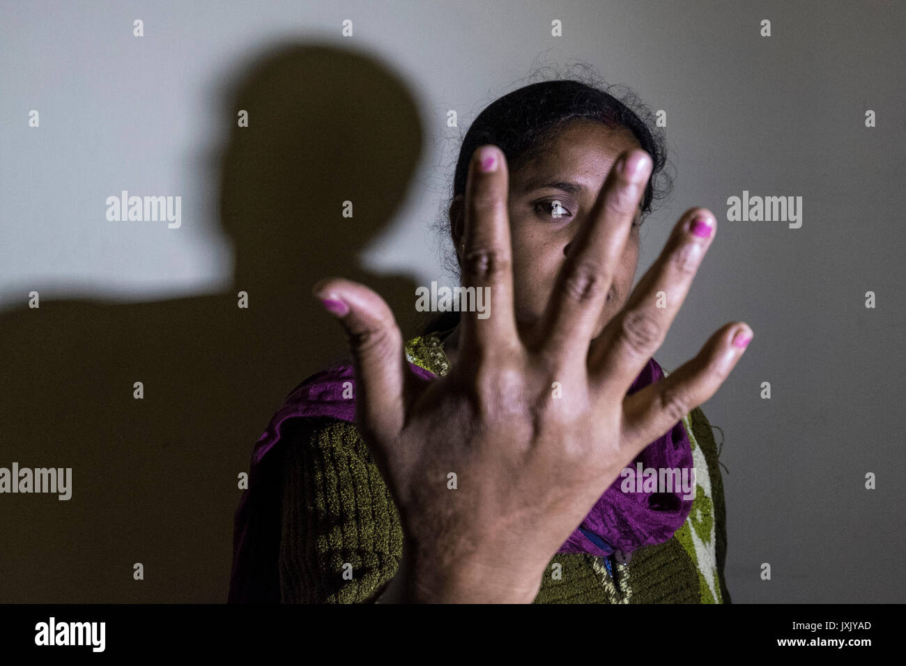 India, Kolkata, Women victims acid attack, portrait Stock Photo