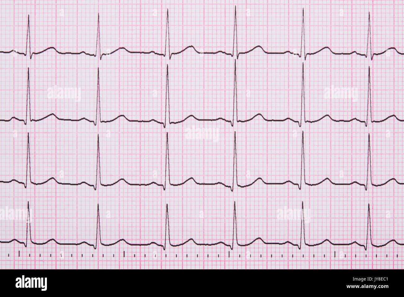Close up of a Electrocardiograph also known as a EKG or ECG graph Stock Photo