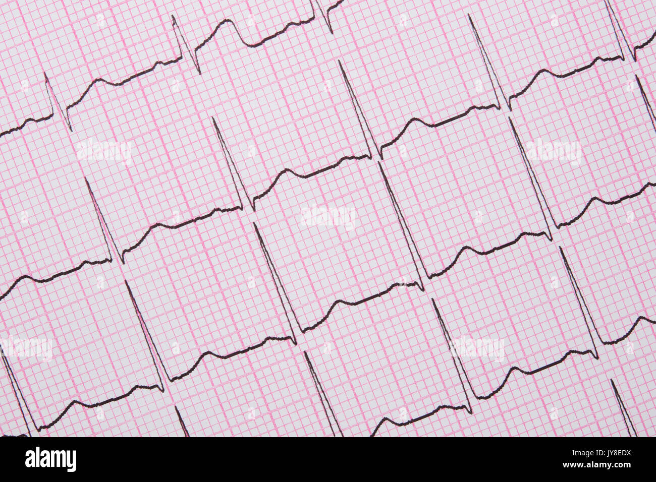 Close up of a Electrocardiograph also known as a EKG or ECG graph Stock Photo