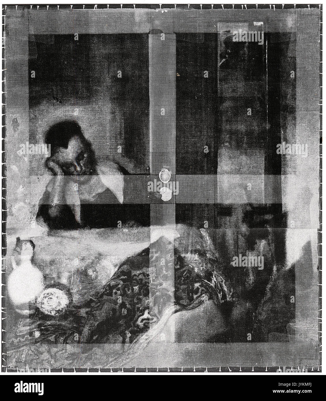 Radiograph display hi-res stock photography and images - Alamy