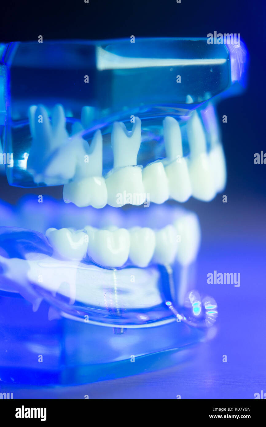 Dental teeth orthodontic dentistry teachng model with gums, tooth ...