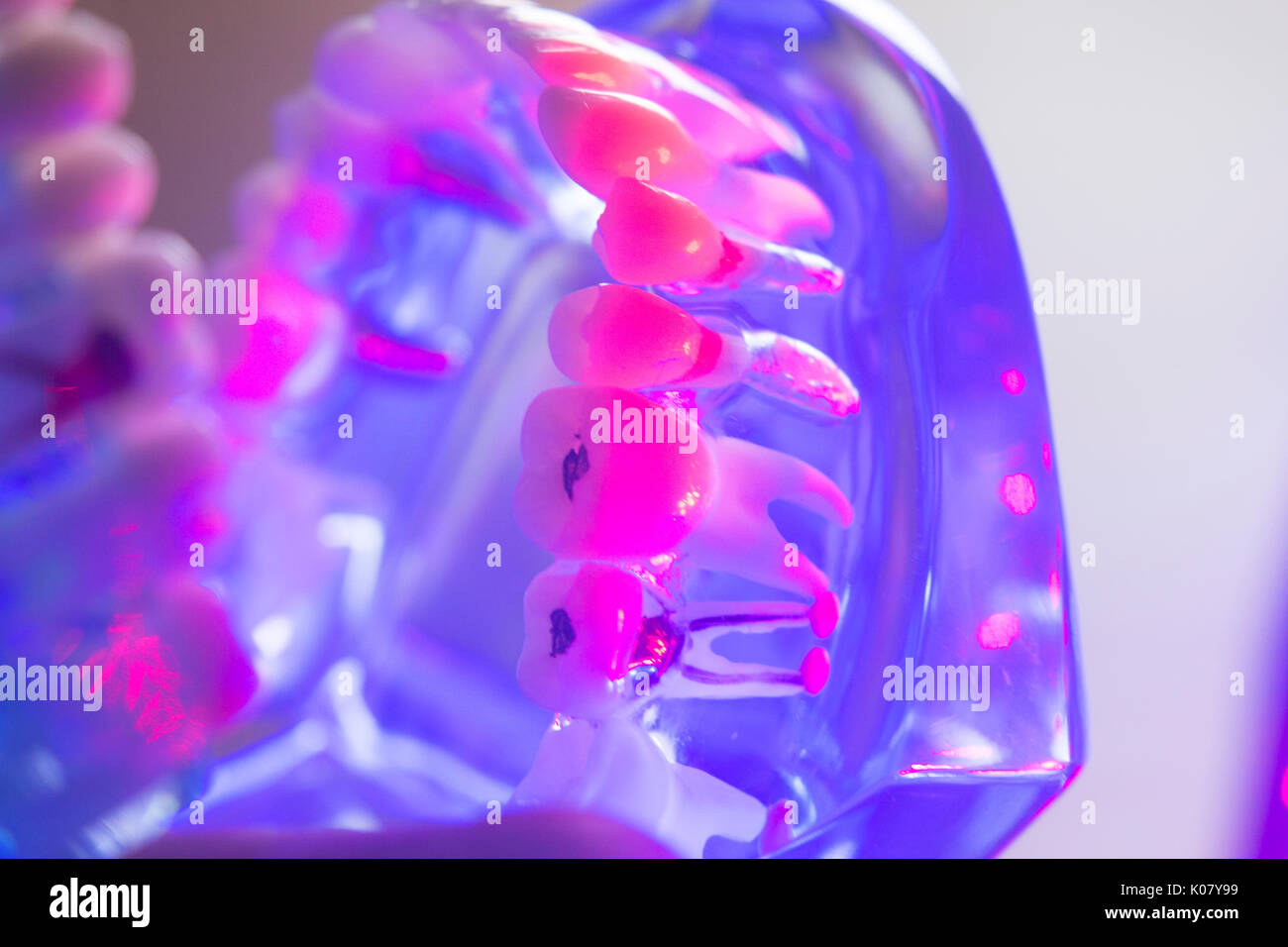 Dental teeth orthodontic dentistry teachng model with gums, tooth