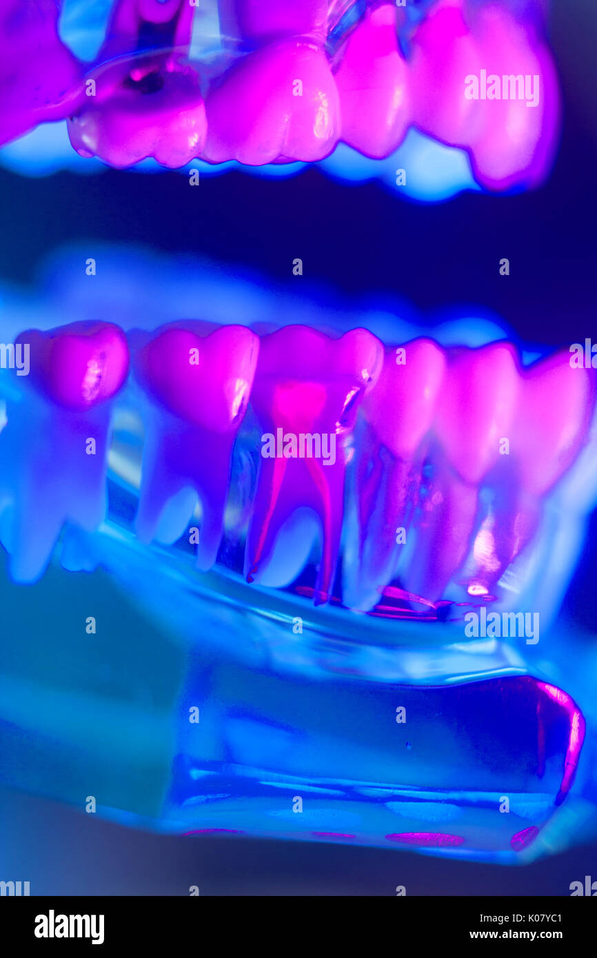 Dental teeth orthodontic dentistry teachng model with gums, tooth