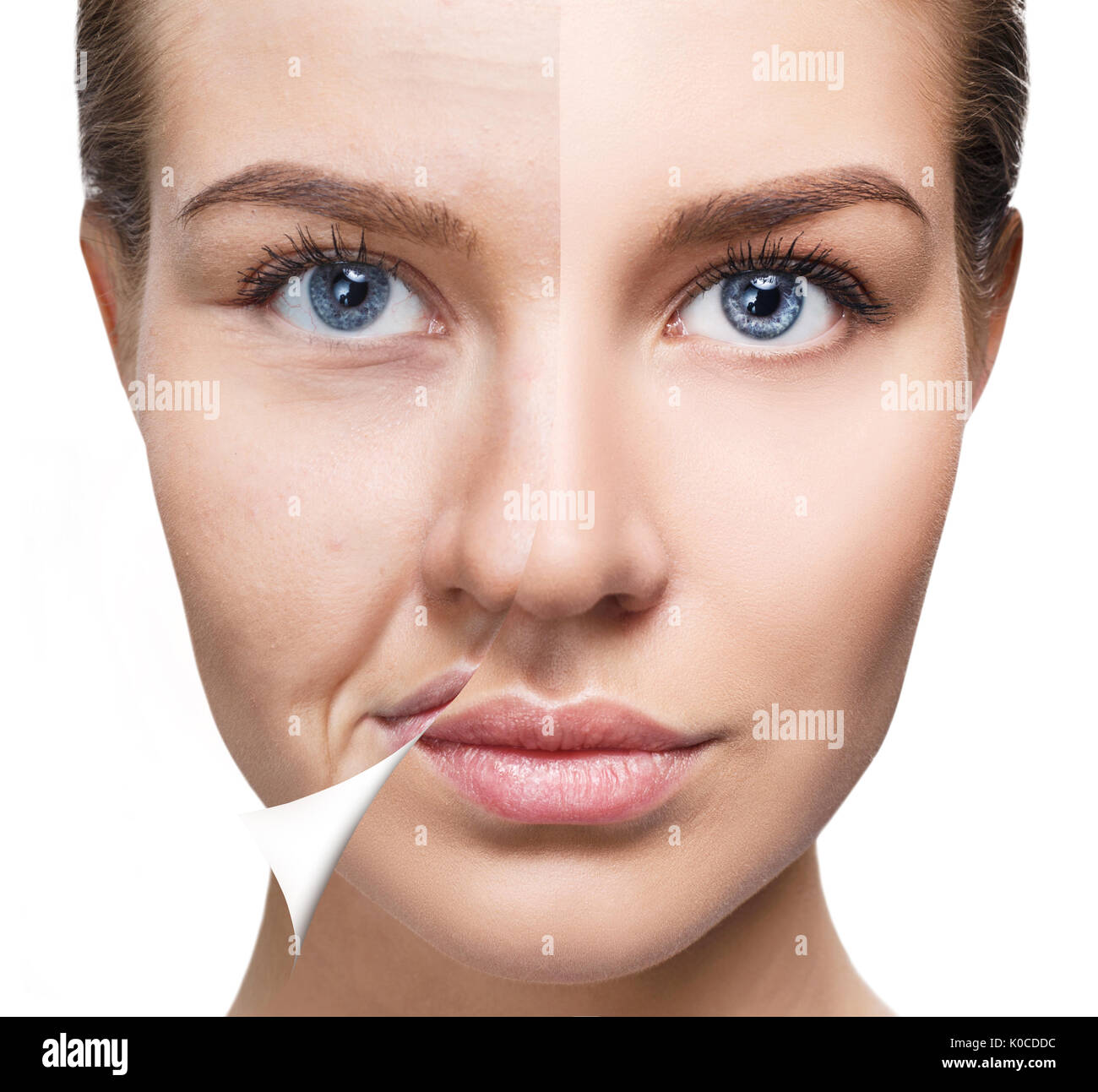 Woman's face before and after rejuvenation. Stock Photo