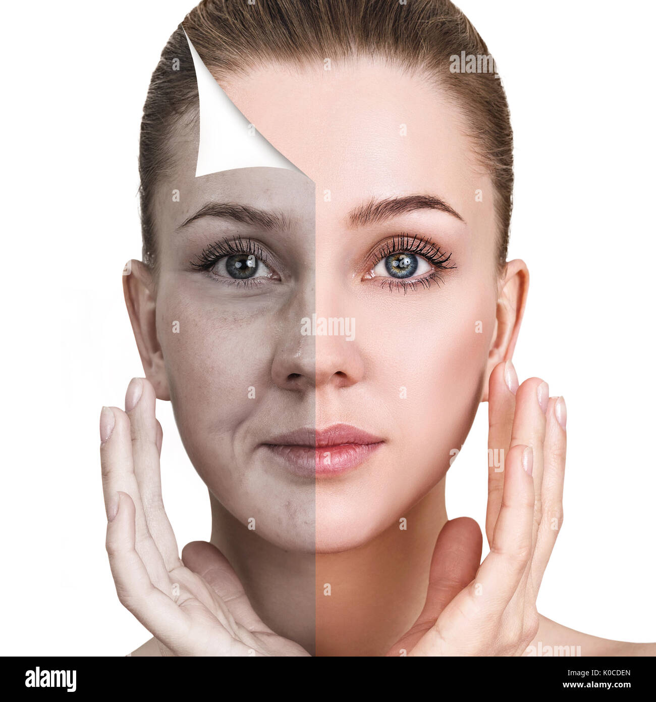 Woman's face before and after rejuvenation Stock Photo Alamy