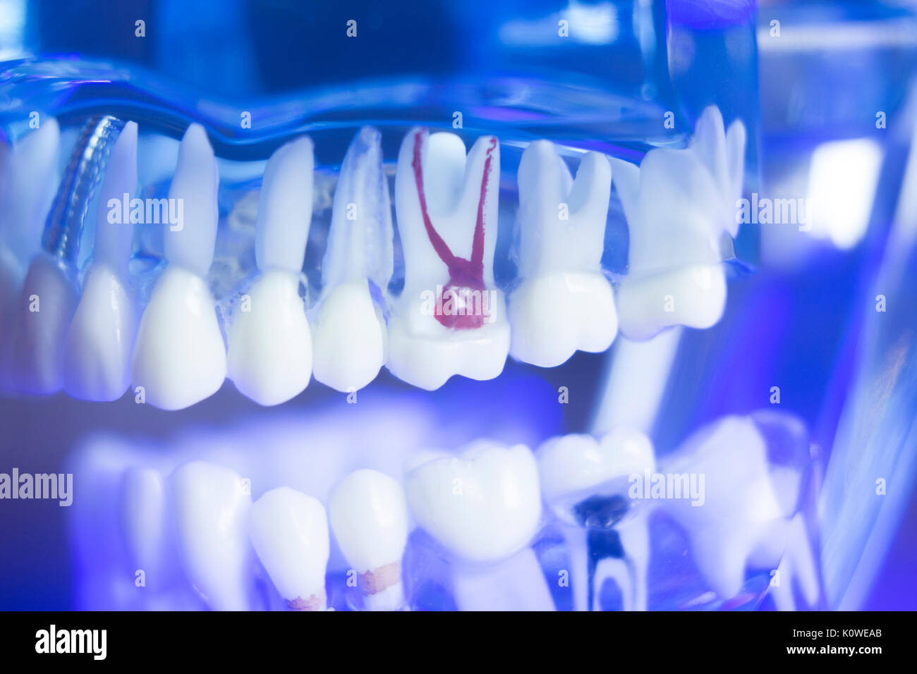 Dental teeth orthodontic dentistry teachng model with gums, tooth