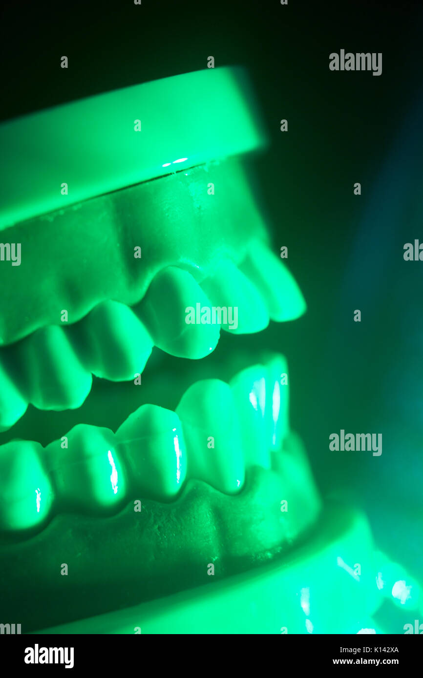 Dental teeth orthodontic dentistry teachng model with gums, tooth