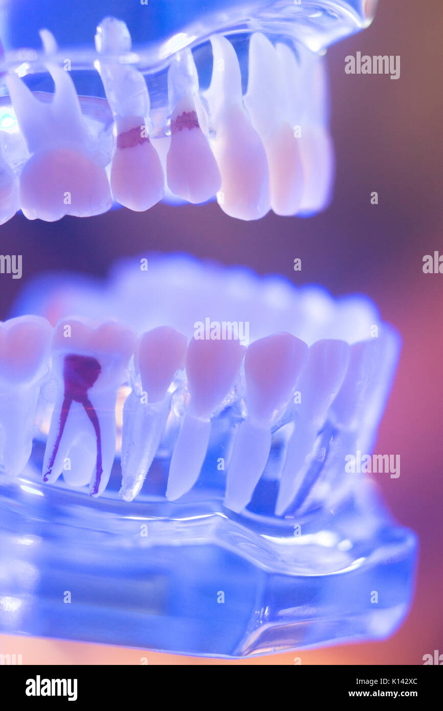 Dental teeth orthodontic dentistry teachng model with gums, tooth