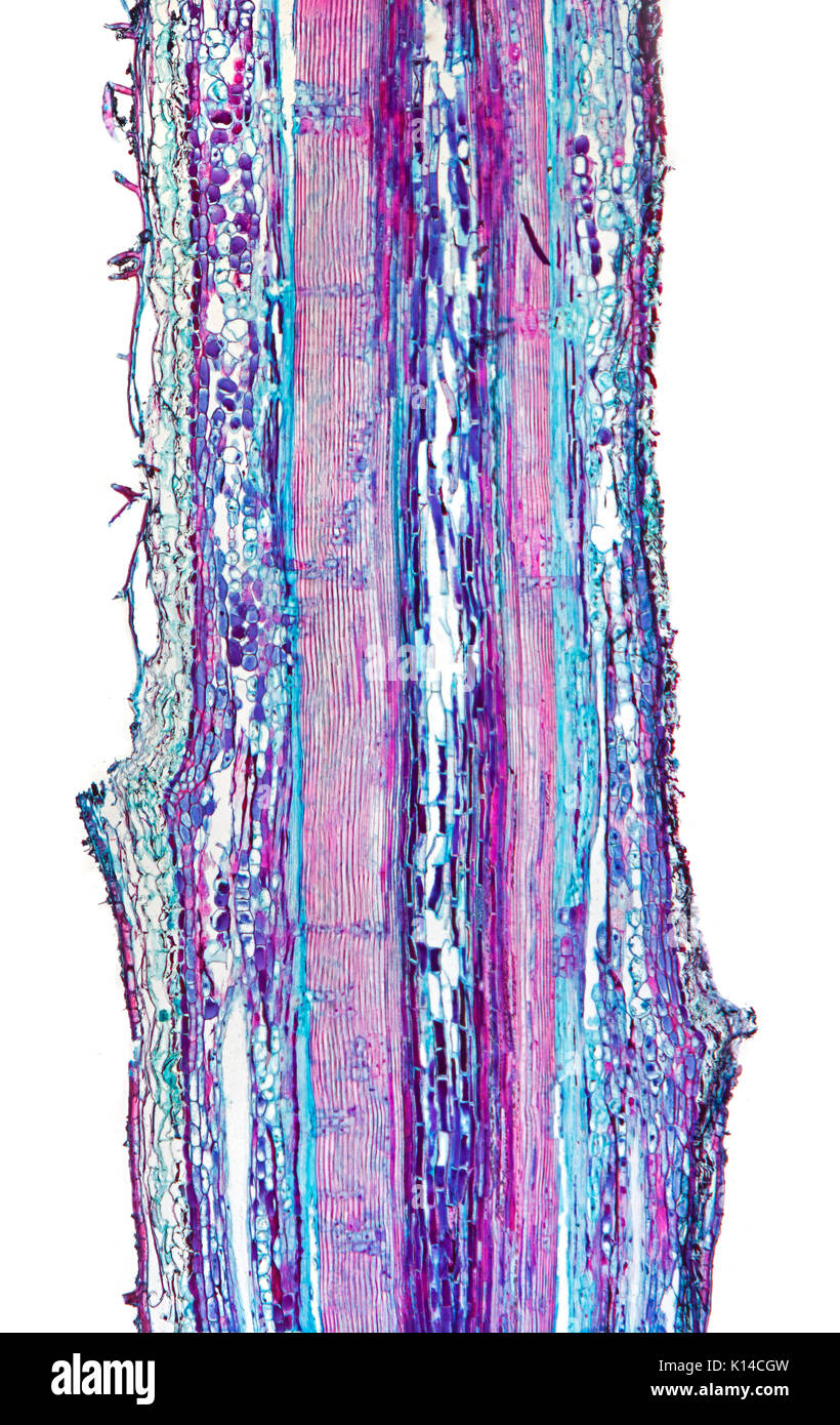 Brightfield photomicrograph, Pinus sp, leaf section, stalk Stock Photo