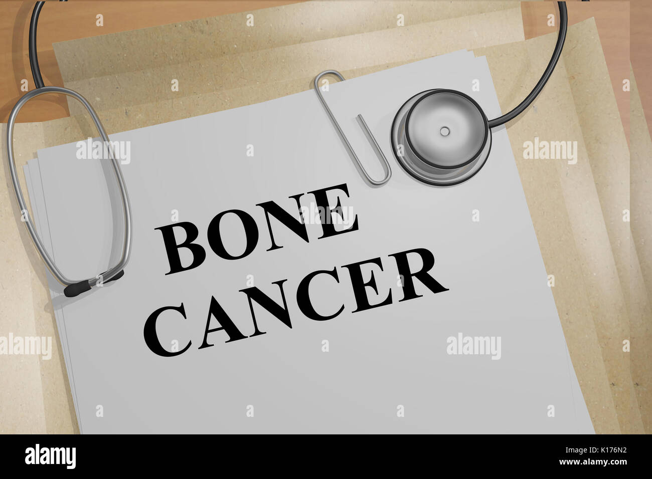 3D illustration of 'BONE CANCER' title on medical documents. Medical concept. Stock Photo