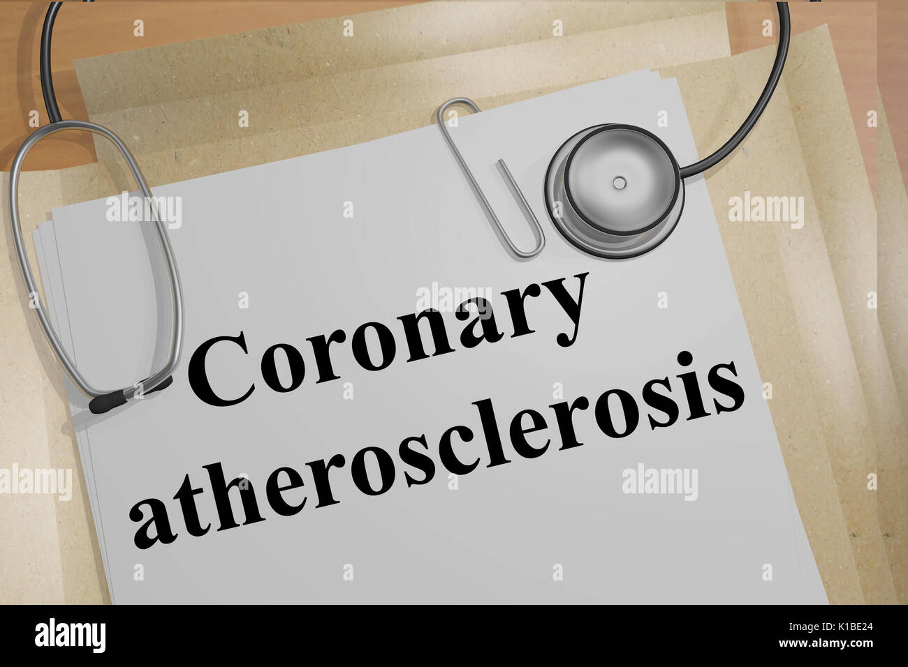 Render illustration of Coronary atherosclerosis title on Medical Documents Stock Photo