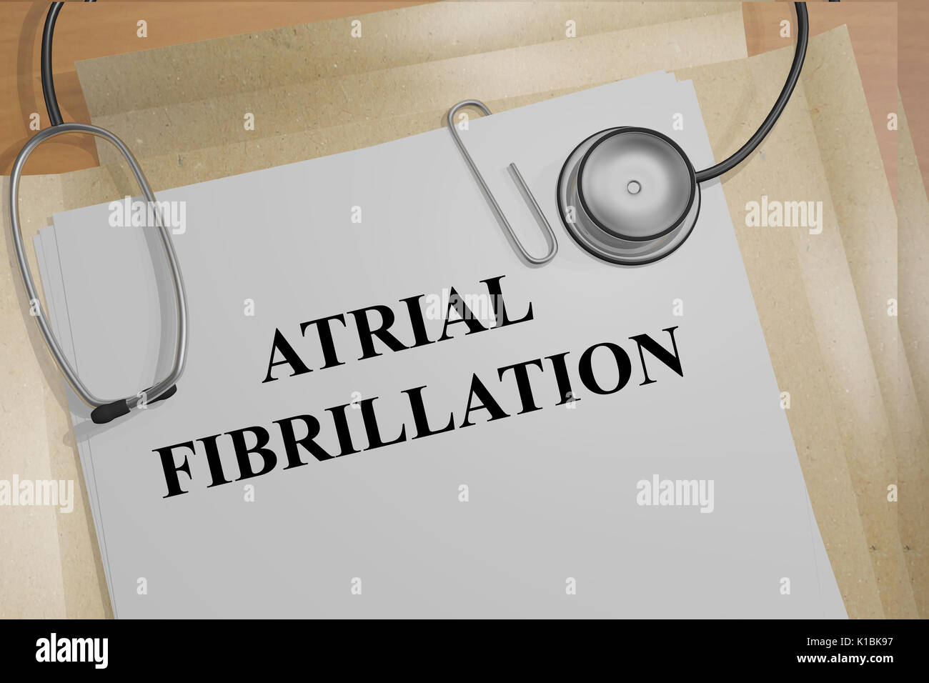Render illustration of Atrial Fibrillation title on medical documents Stock Photo