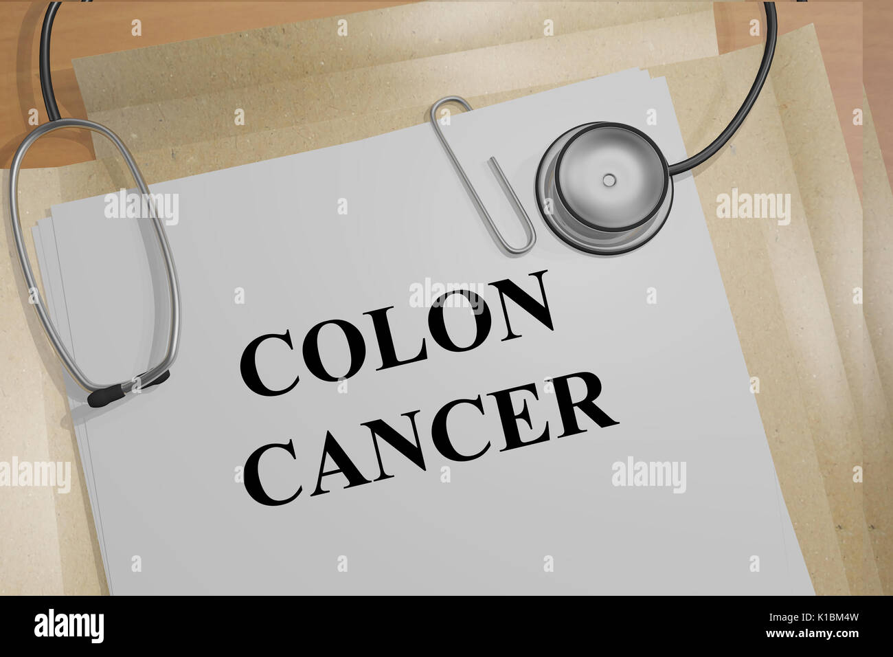 Render illustration of Colon Cancer title on medical documents Stock Photo