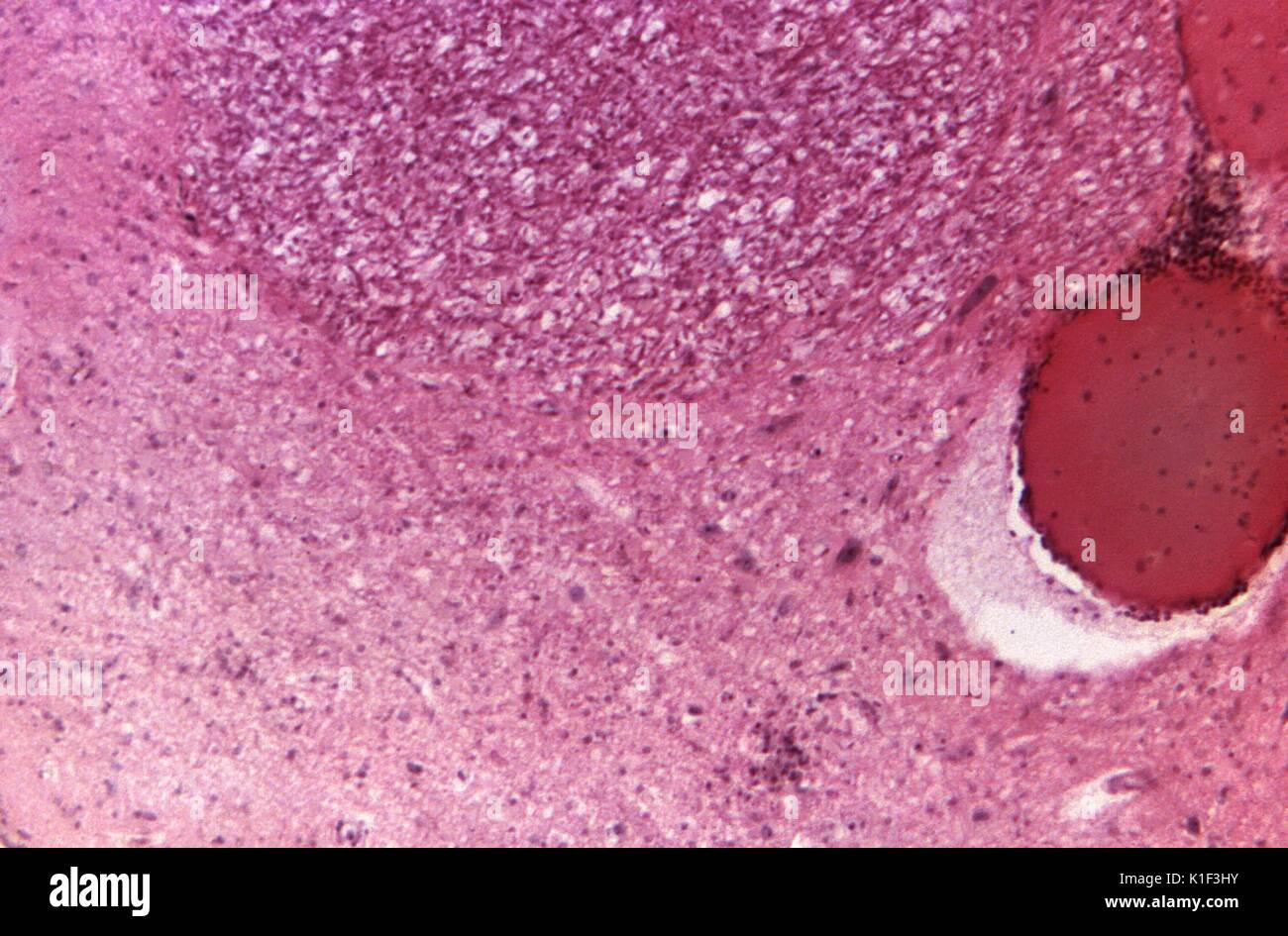 Under a low magnification of 40X, this photomicrograph of a brain ...
