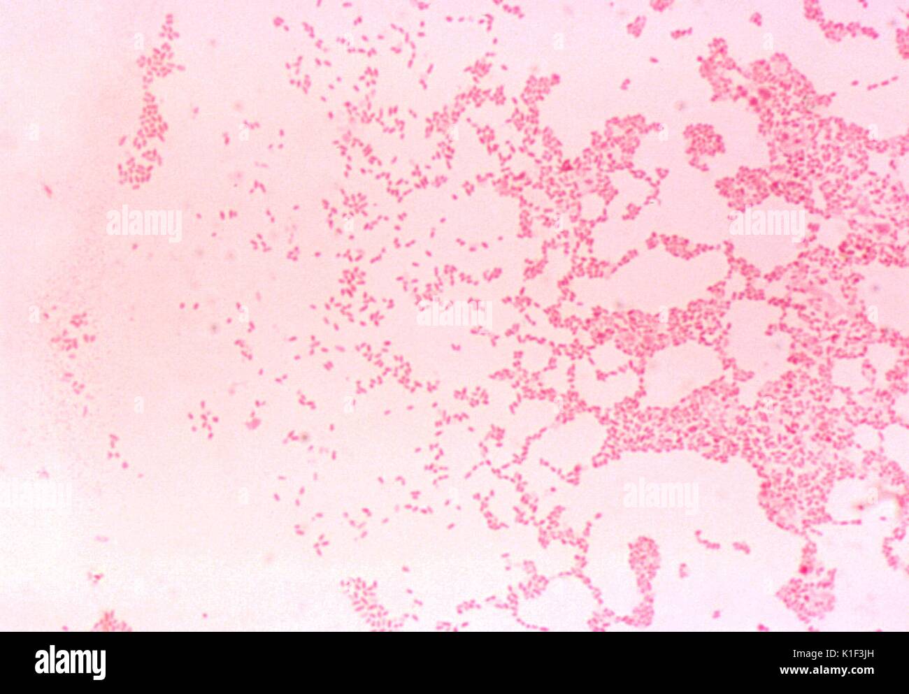 Brucella melitensis Gram-stain. Brucella melitensis is a Gram-negative staining coccobacillus, and is the cause of the zoonotic disease, Brucellosis, an illness found in animals, but able to be transmitted to humans. Image courtesy CDC/Dr. W.A. Clark, 1977. Stock Photo