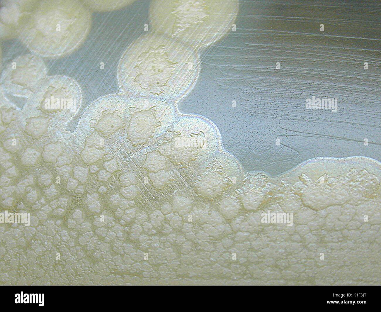 Clostridium botulinum growing on egg yolk agar showing the lipase reaction after 72 hours of incubation. C. botulinum is a strictly anaerobic bacterium that when grown on egg yolk agar, its colonies will exhibit a lipase reaction, described as the shiny area around each colony. Image courtesy CDC/Courtesy of Larry Stauffer, Oregon State Public Health Laboratory, 2002. Stock Photo