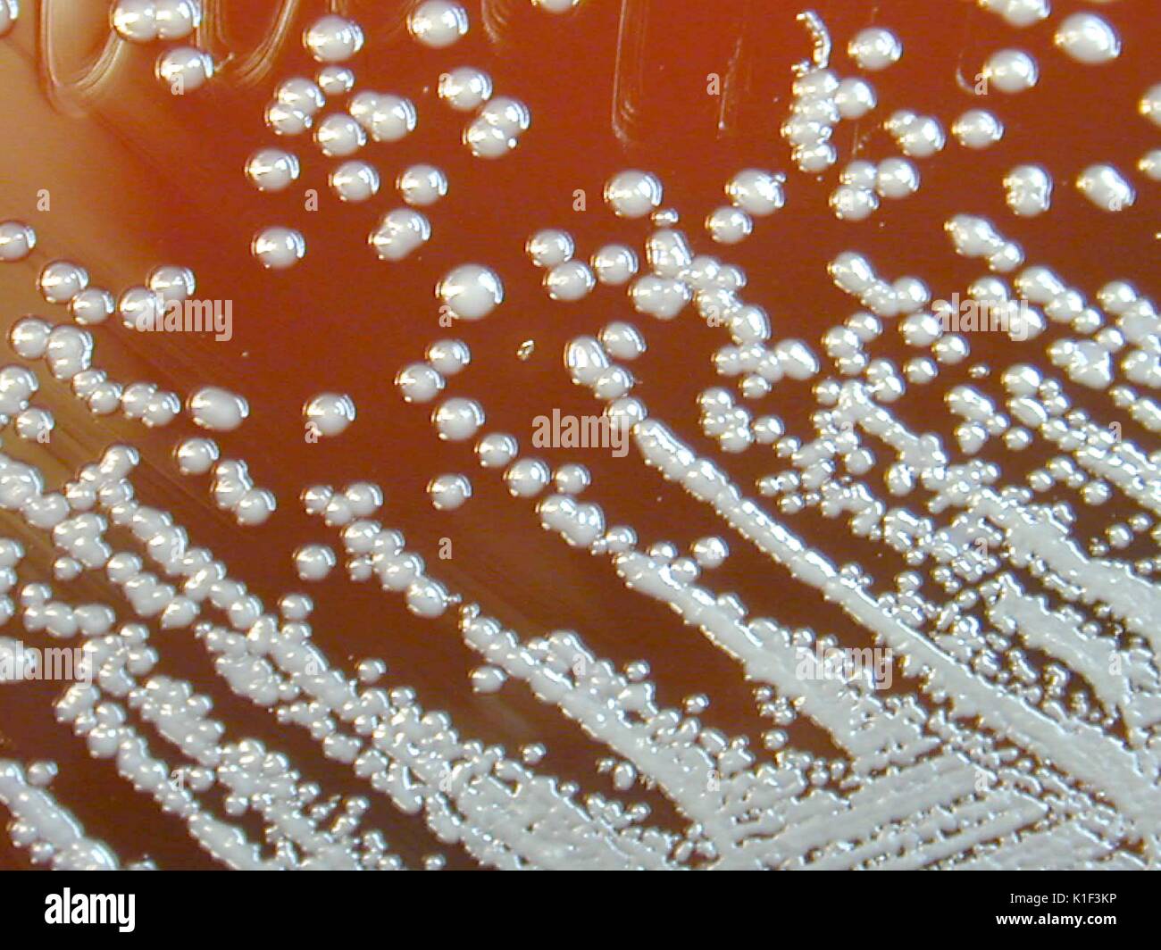 Burkholderia pseudomallei grown on sheep blood agar for 48 hours. Burkholderia pseudomallei is a Gram-negative aerobic bacteria, and is the causative agent of melioidosis. The organism's colonial morphology changes somewhat as the incubation is extended. Image courtesy CDC/Courtesy of Larry Stauffer, Oregon State Public Health Laboratory, 2002. Stock Photo