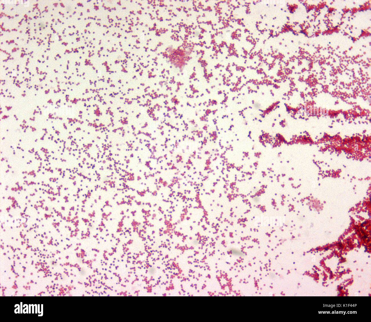 Francisella tularensis is Gram-negative in its staining morphology. Francisella tularensis is a poorly staining, very tiny gram-negative coccobacillus (0.2-0.7 {micro}m), seen mostly as single cells. Bipolar staining is not a distinctive feature. Image courtesy CDC/Courtesy of Larry Stauffer, Oregon State Public Health Laboratory, 2002. Stock Photo