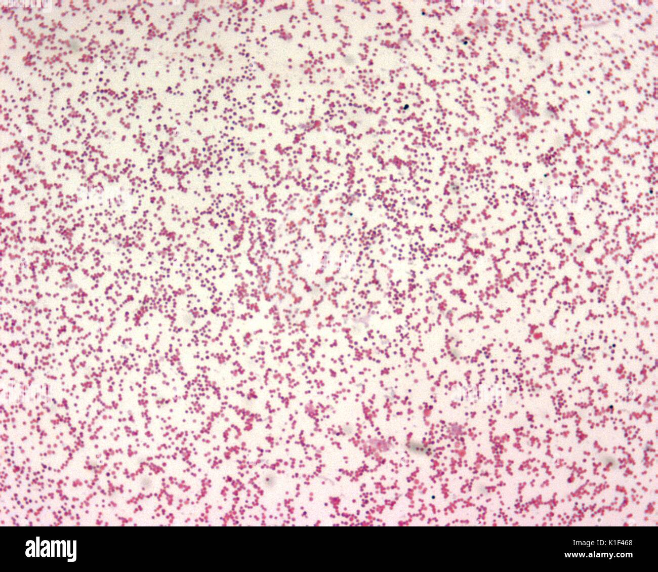 Francisella tularensis is Gram-negative in its staining morphology. Francisella tularensis is a poorly staining, very tiny gram-negative coccobacillus (0.2-0.7 {micro}m), seen mostly as single cells. Bipolar staining is not a distinctive feature. Image courtesy CDC/Courtesy of Larry Stauffer, Oregon State Public Health Laboratory, 2002. Stock Photo