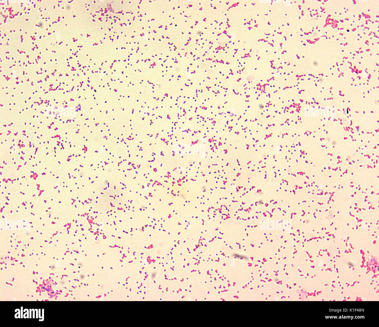 Brucella spp. are gram-negative in their staining morphology. Brucella spp. are poorly staining, small gram-negative coccobacilli (0.5-0.7 x 0.6-1.5 {micro}m), and are seen mostly as single cells and appearing like ?fine sand?. Image courtesy CDC/Courtesy of Larry Stauffer, Oregon State Public Health Laboratory, 2002. Stock Photo