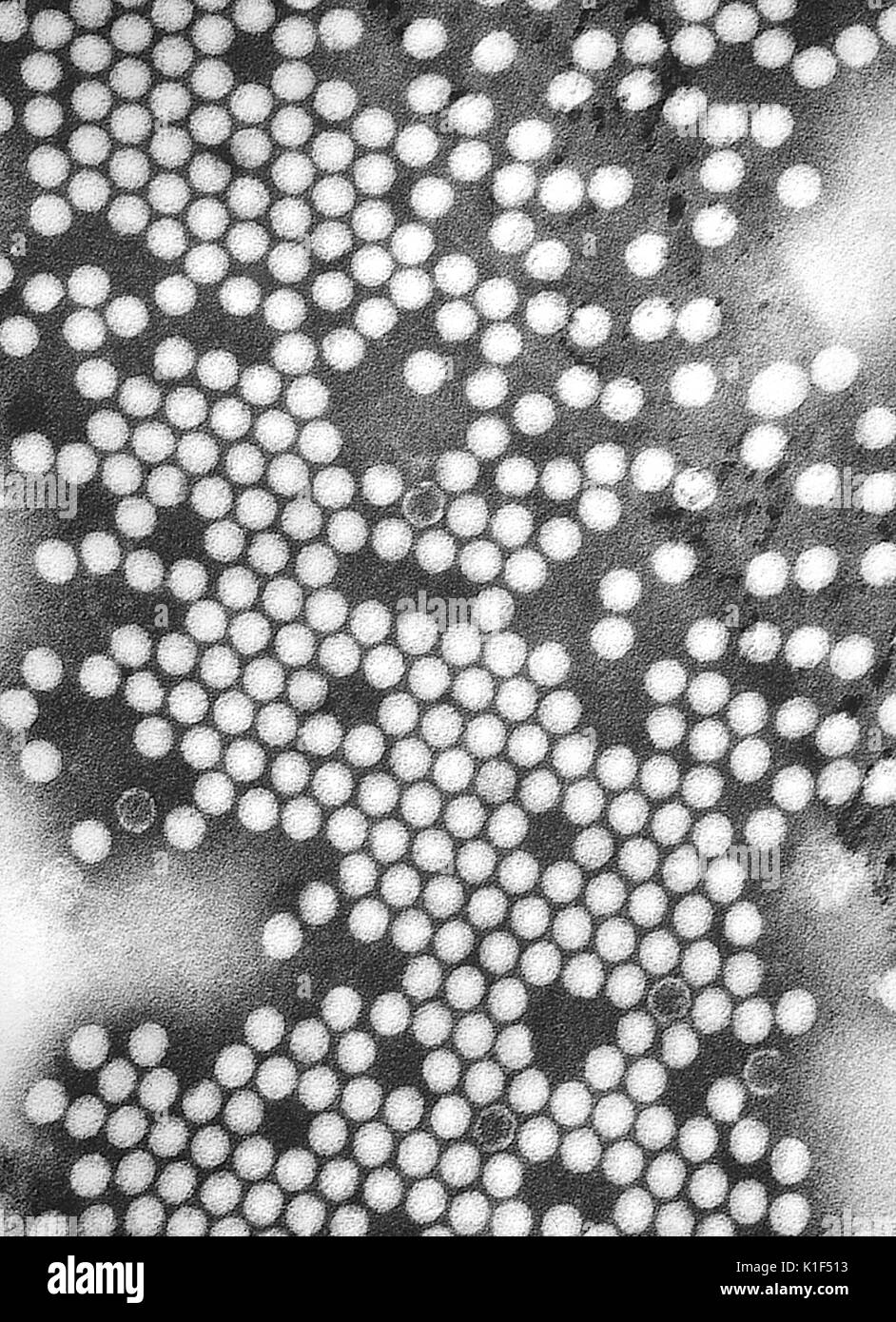 Electron micrograph of the poliovirus. Poliovirus is a species of Enterovirus, which is a Genus in the family of Picornaviridae, and is an RNA virus. Image courtesy CDC/Dr. Fred Murphy, Sylvia Whitfield, 1975. Stock Photo