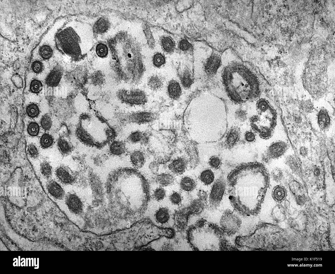 Transmission electron micrograph (TEM) of the Marburg virus. Marburg virus, first recognized in 1967, causes a severe type of hemorrhagic fever, which affects humans, as well as non-human primates. Image courtesy CDC/Dr. Fred Murphy, Sylvia Whitfield, 1975. Stock Photo
