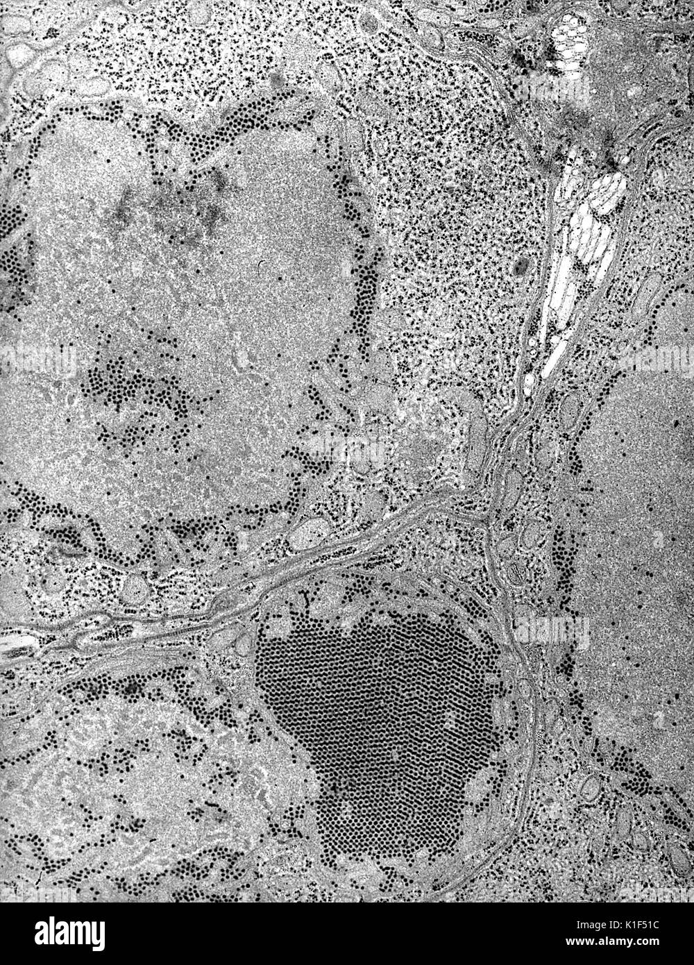 Electron micrograph of the St. Louis Encephalitis (SLE) virus. St. Louis Encephalitis (SLE) virus seen in a mosquito salivary gland, is normally transmitted to humans though the bite of a Culex mosquito. Image courtesy CDC/Dr. Fred Murphy, Sylvia Whitfield, 1975. Stock Photo