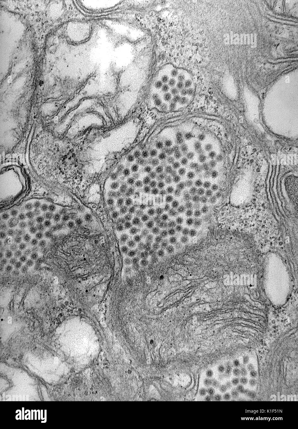 Electron micrograph of the Eastern Equine Encephalitis virus in a mosquito salivary gland, Alphavirus, EEE. Image courtesy CDC/Dr. Fred Murphy, Sylvia Whitfield, 1975. Stock Photo