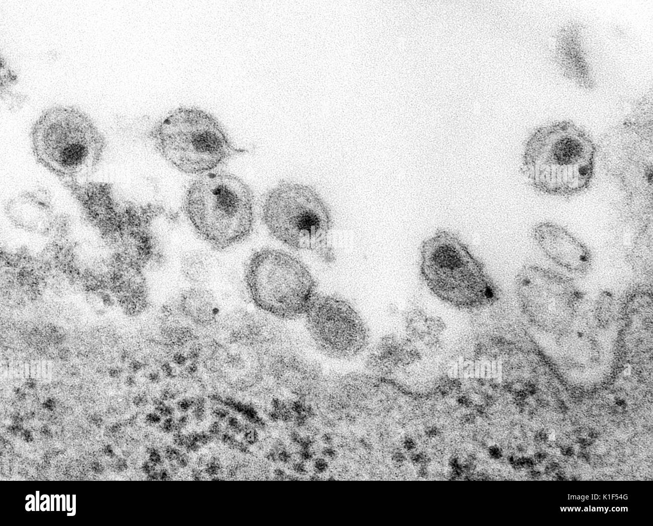 Human immunodeficiency virus (HIV), co-cultivated with human lymphocytes. See PHIL 14272, for a slightly lower magnification of this tissue sample. Image courtesy CDC/A. Harrison, P. Feorino, E. L. Palmer, 1984. Stock Photo
