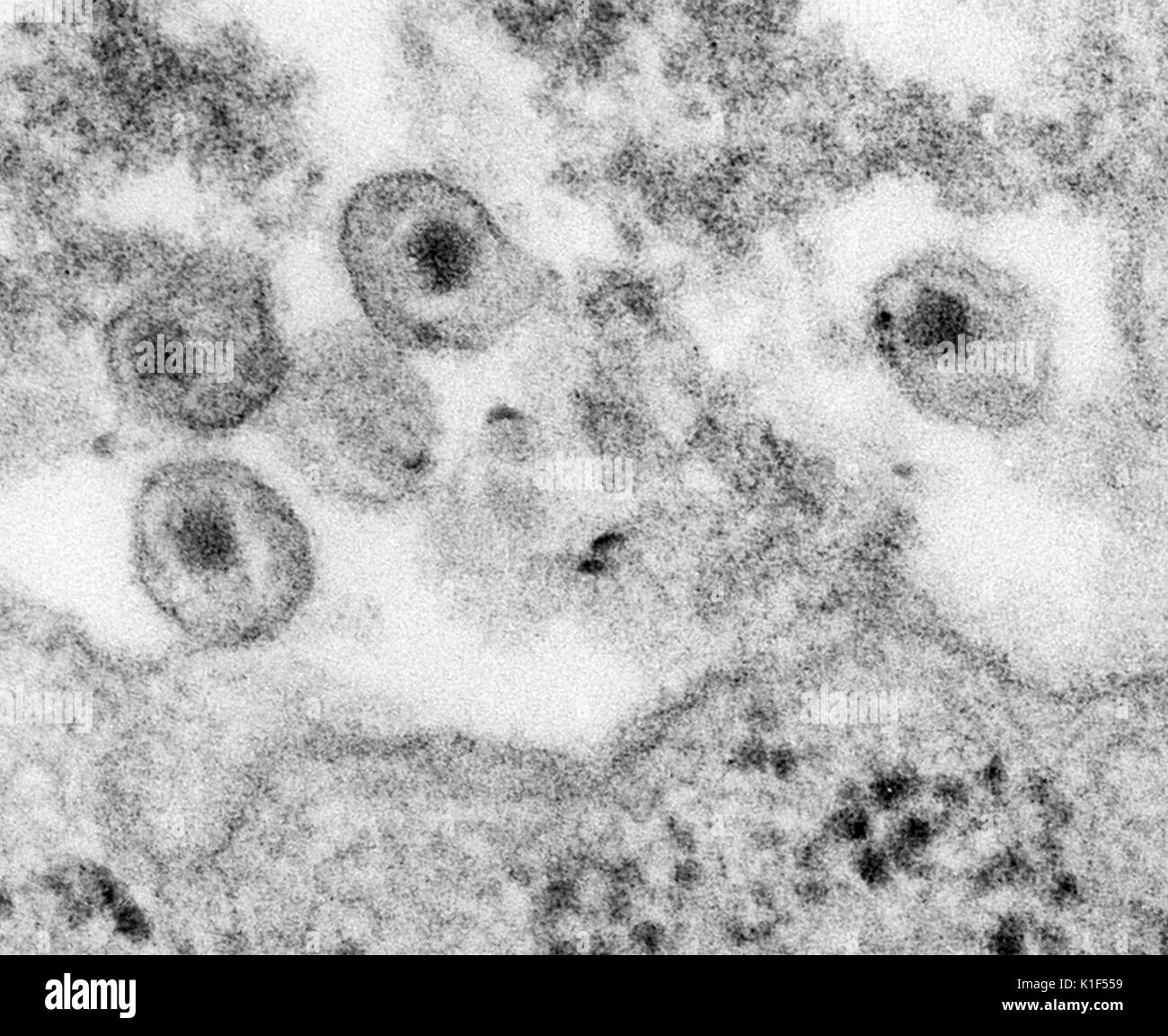Transmission electron micrograph (TEM), human immunodeficiency virus (HIV), co-cultivated with human lymphocytes. Image courtesy CDC/A. Harrison, P. Feorino, E. L. Palmer, 1984. Stock Photo