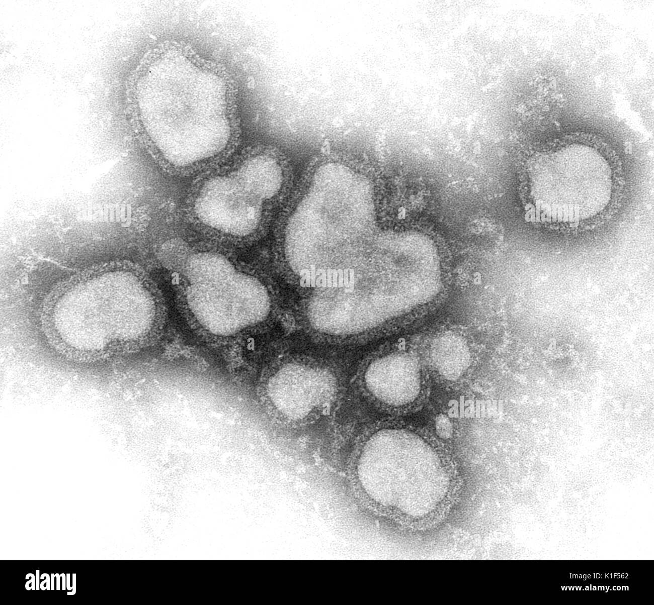 This negative-stained transmission electron micrograph (TEM) depicted a number of influenza A virions. There are three types of influenza viruses: A, B and C. Human influenza A and B viruses cause seasonal epidemics of disease almost every winter in the United States. The emergence of a new and very different influenza virus to infect people can cause an influenza pandemic. Influenza type C infections cause a mild respiratory illness and are not thought to cause epidemics. For a colorized version of this image see PHIL 11702. IMGSETINF. Image courtesy CDC/F. A. Murphy, 1976. Stock Photo