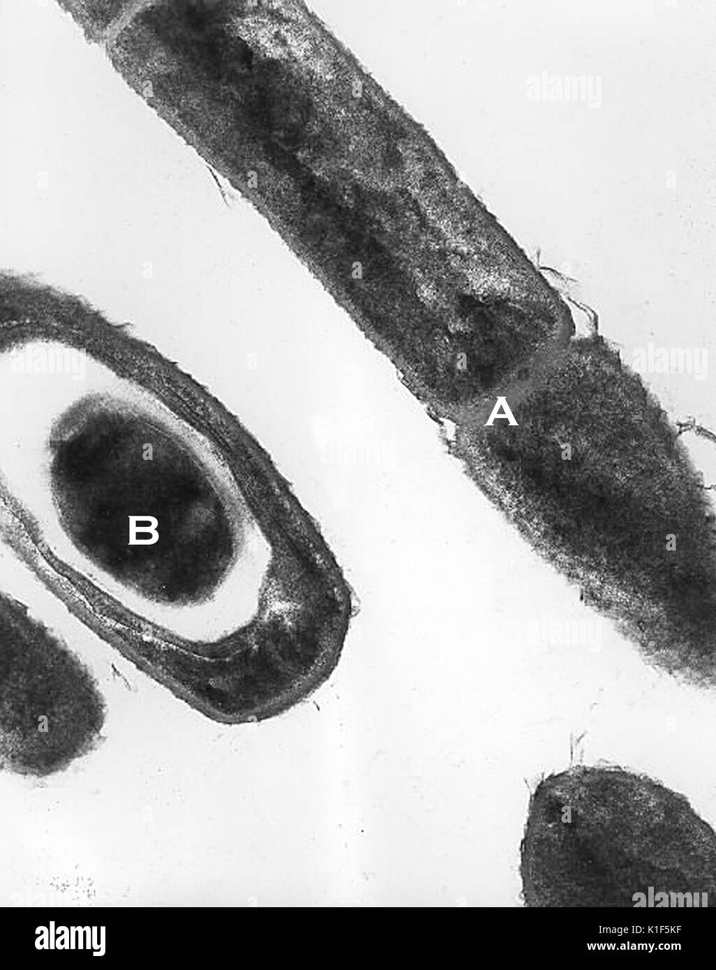 Transmission electron micrograph of Bacillus anthracis . Transmission electron micrographic image of Bacillus anthracis from an anthrax culture, showing cell division (A), and spores (B). Image courtesy CDC/Dr. Sherif Zaki, Elizabeth White, 2001. Stock Photo