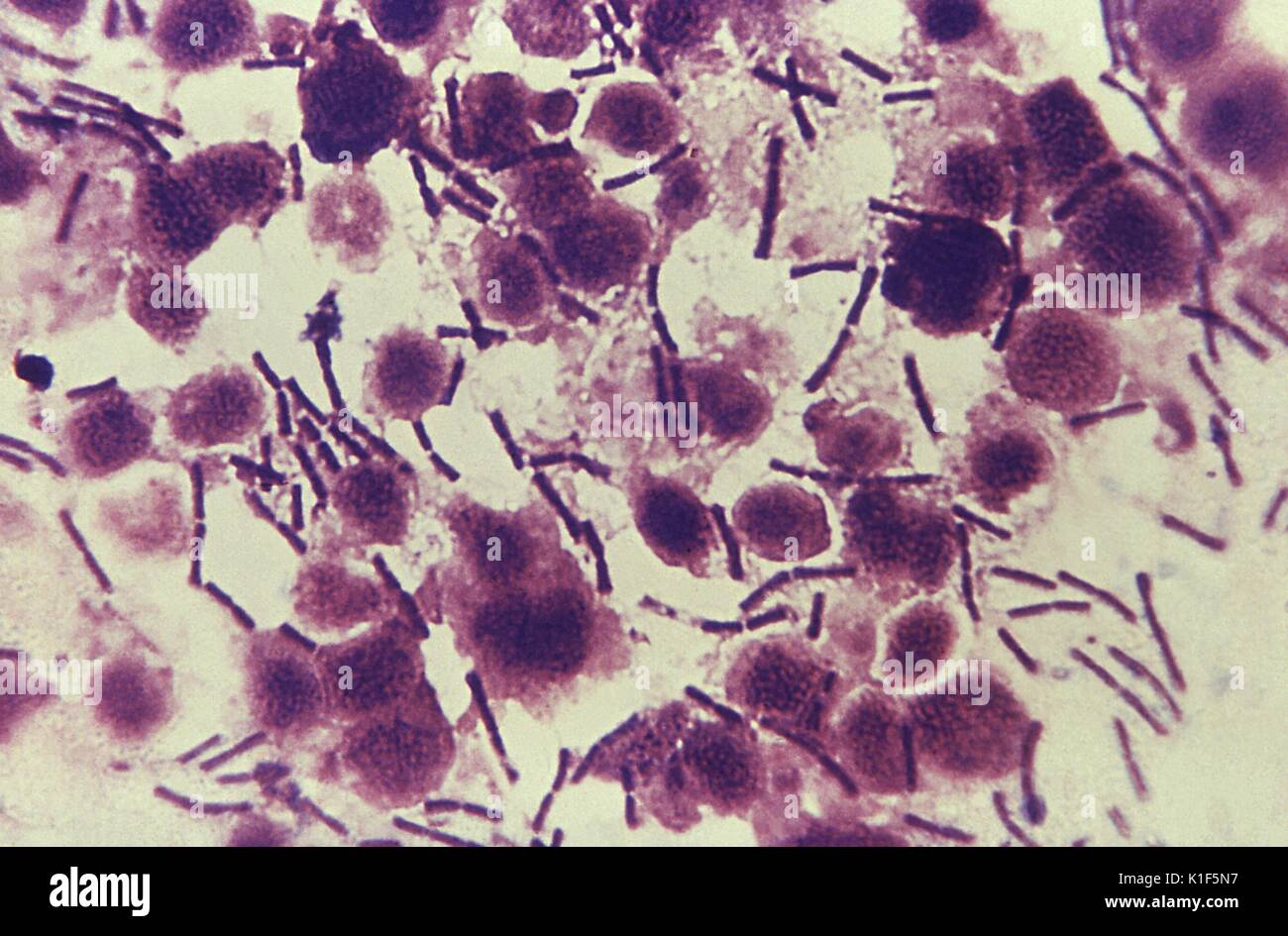This photomicrograph reveals numerous rod-shaped Bacillus anthracis bacteria, some that had linked together to form chains, while others remained solitary. Anthrax is a naturally-occurring disease of animals (e.g. sheep, goats, and cattle) caused by the bacterium Bacillus anthracis . The bacteria live in the soil in many parts of the world and form protective outer coats called spores (hereafter called anthrax spores). Spores are able to withstand harsh or adverse conditions that would normally kill bacteria. Animals can get anthrax by ingesting anthrax spores from the soil. Anthrax in animals Stock Photo