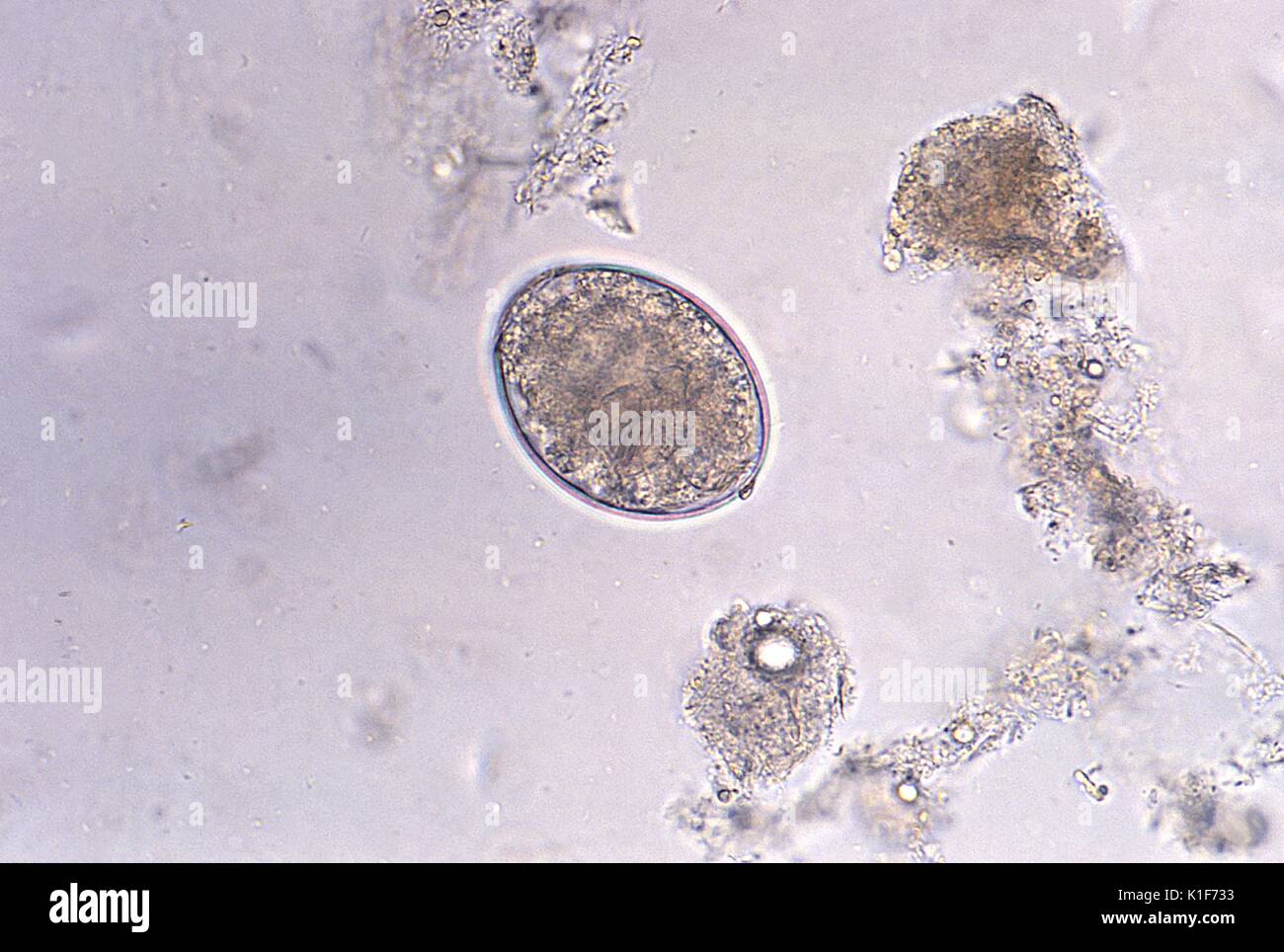 Diphyllobothrium latum High Resolution Stock Photography and Images Alamy