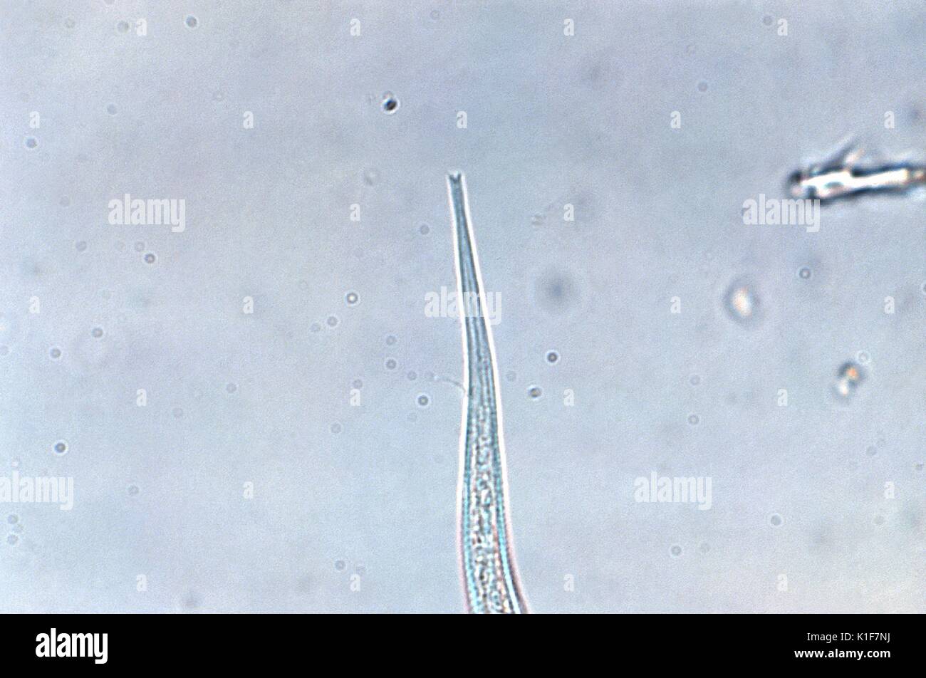 Under a magnification of 600X, this photomicrograph reveals ultrastructural details displayed on the tail-end of a parasitic nematode (roundworm), Strongyloides stercoralis, which included its characteristic notch. Though frequently asymptomatic when present, clinical features of a strongyloidiasis infection include gastrointestinal symptoms such as abdominal pain and diarrhea. Pulmonary symptoms (including Loeffler?s syndrome) can occur during pulmonary migration of the filariform larvae. Dermatologic manifestations include urticarial rashes in the buttocks and waist areas. Disseminated stron Stock Photo